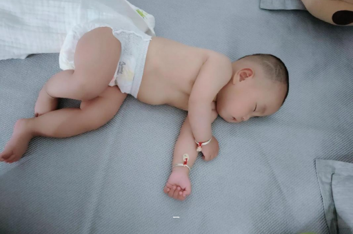 海南宝宝脸上有白色斑块 海南宝宝脸上有白色斑块